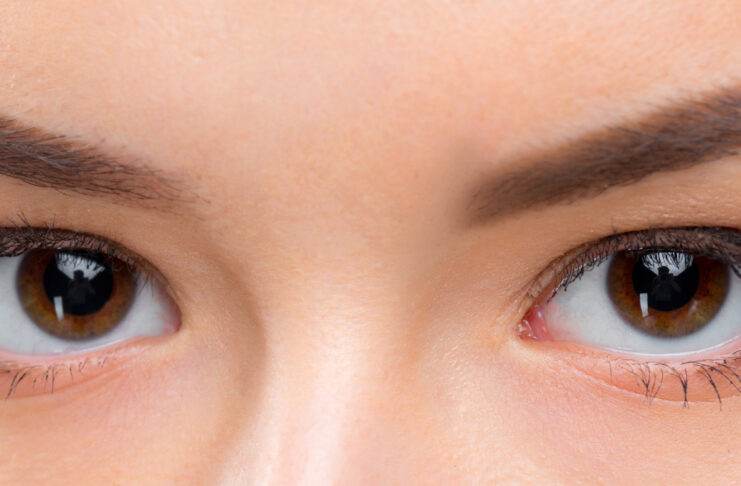 deep set eyes